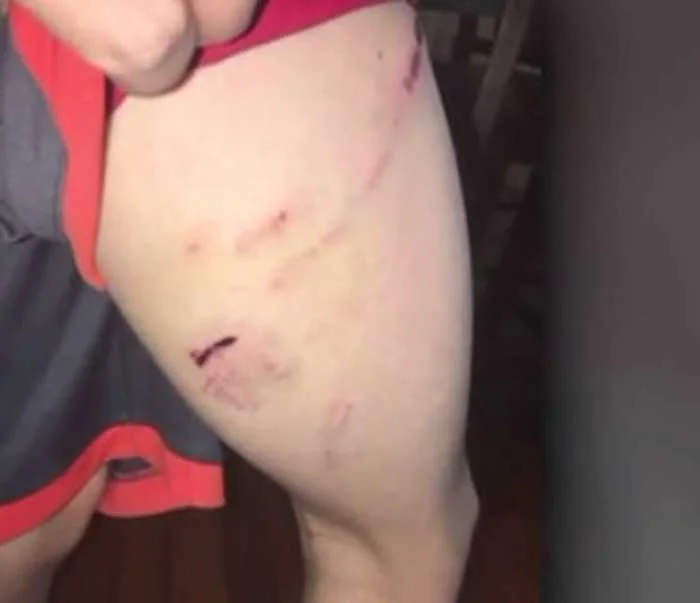 El hijo de Long sufrió leves heridas