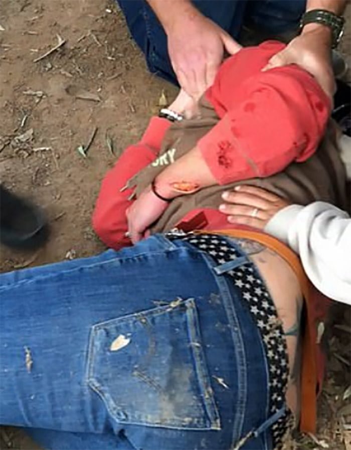Mujer atacada por jaguar