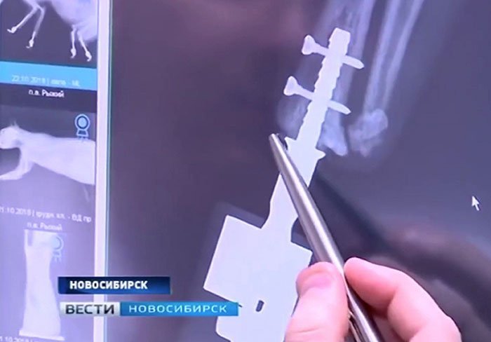 Medico explica procedimiento Medico explica procedimiento